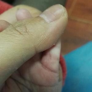 小儿推拿